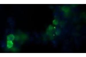 Image no. 2 for anti-Pogo Transposable Element with KRAB Domain (POGK) antibody (ABIN1500328) (POGK antibody)