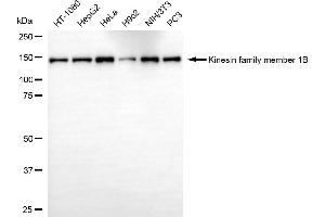 Western blotting analysis using kinesin family member 1B antibody (ABIN7799201). (KIF1B antibody)