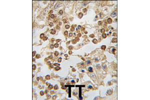 Formalin-fixed and paraffin-embedded human testis tissue reacted with DPPA4 polyclonal antibody  , which was peroxidase-conjugated to the secondary antibody, followed by DAB staining.