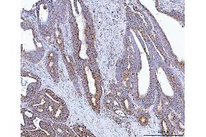 IHC analysis of GLUD1/2 using anti-GLUD1/2 antibody (ABIN7602000). (GLUD1 / GLUD2 (AA 54-553) antibody)