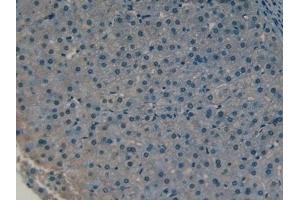 Detection of CLL1 in Human Liver Tissue using Polyclonal Antibody to Collectin Liver 1 (CLL1) (COLEC10 antibody  (AA 34-277))