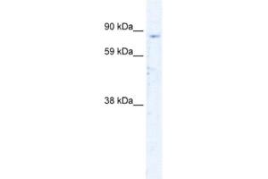 Western Blotting (WB) image for anti-Sirtuin 1 (SIRT1) antibody (ABIN2460449)
