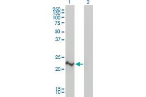 Western Blot analysis of CRADD expression in transfected 293T cell line by CRADD monoclonal antibody (M01), clone 1F8. (CRADD antibody  (AA 1-199))