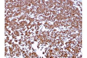 Formalin-fixed, paraffin-embedded human Tonsil stained with CD20 Mouse Monoclonal Antibody (MS4A1/3409).