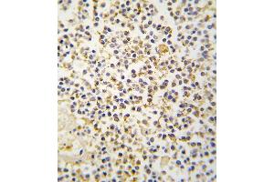 Formalin-fixed and paraffin-embedded human kideny tissue reacted with ALDH1A3 antibody (N-term), which was peroxidase-conjugated to the secondary antibody, followed by DAB staining. (ALDH1A3 antibody  (N-Term))