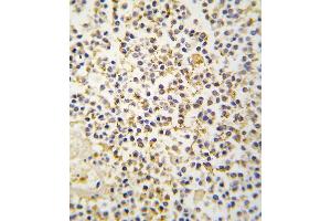 Formalin-fixed and paraffin-embedded human kideny tissue reacted with ALDH1A3 antibody (N-term), which was peroxidase-conjugated to the secondary antibody, followed by DAB staining.