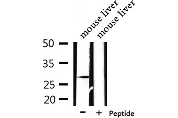 PEX11A antibody  (Internal Region)