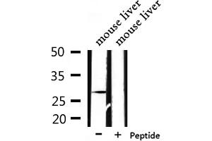 Western blot analysis of extracts from mouse liver, using PEX11A Antibody. (PEX11A antibody  (Internal Region))