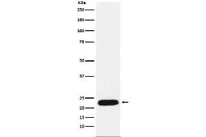 Western blot analysis of mtTFA expression in MCF7 cell lysate.