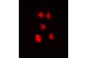 Immunofluorescent analysis of ZNF148 staining in Hela cells. (ZNF148 antibody  (N-Term))