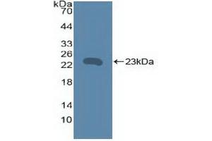 Western blot analysis of recombinant Human TNFRSF5. (CD40 antibody  (AA 26-187))