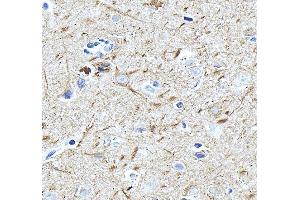 anti-Internexin Neuronal Intermediate Filament Protein, alpha (INA) (AA 71-161) antibody