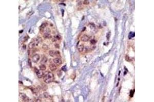 Immunohistochemistry (IHC) image for anti-FYN Oncogene Related To SRC, FGR, YES (FYN) (AA 13-43) antibody (ABIN3031009)