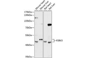 Western blot analysis of extracts of various cell lines, using P2RX3 antibody (ABIN6132577, ABIN6145111, ABIN6145114 and ABIN6216793) at 1:3000 dilution. (P2RX3 antibody  (AA 328-397))