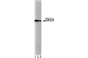 Western blot analysis of Akt on HCT-8 cell lysate. (AKT1 antibody)