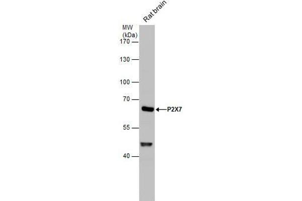 P2RX7 antibody  (Center)