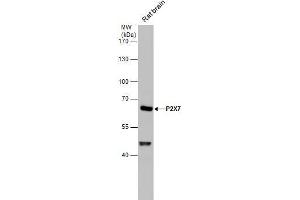 WB Image P2X7 antibody detects P2X7 protein by western blot analysis. (P2RX7 antibody  (Center))