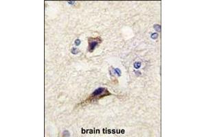 Formalin-fixed and paraffin-embedded human brain tissue reacted with NTF3 antibody , which was peroxidase-conjugated to the secondary antibody, followed by DAB staining. (Neurotrophin 3 antibody  (AA 122-151))