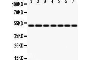 Western Blotting (WB) image for anti-Isocitrate Dehydrogenase 2 (NADP+), Mitochondrial (IDH2) (AA 413-447), (C-Term) antibody (ABIN3043856)
