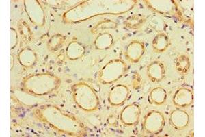 Immunohistochemistry of paraffin-embedded human kidney tissue using ABIN7170920 at dilution of 1:100 (SUGCT antibody  (AA 1-250))