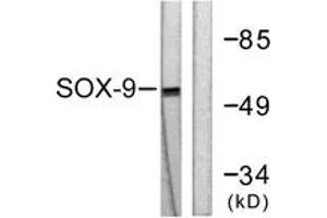 Western blot analysis of extracts from 293 cells, treated with PBS 60', using SOX9 (Ab-181) Antibody.