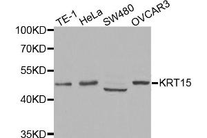 Western blot analysis of extracts of various cell lines, using KRT15 antibody (ABIN5971439) at 1:400 dilution. (KRT15 antibody)