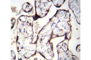 Immunohistochemistry (IHC) image for anti-Transforming Growth Factor, beta Receptor II (70/80kDa) (TGFBR2) (AA 13-40) antibody (ABIN3029224)