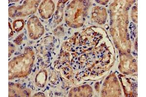 Immunohistochemistry of paraffin-embedded human kidney tissue using ABIN7169035 at dilution of 1:100 (PRKD3 antibody  (AA 326-510))