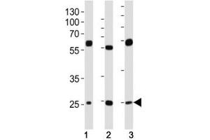 Western blot analysis of lysate from (1) HeLa, (2) HepG2 and (3) U-2OS cell line using TFAM antibody at 1:1000. (TFAM antibody  (AA 216-246))