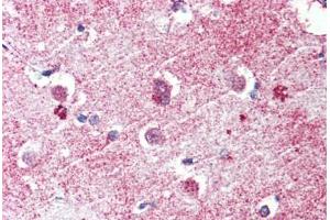 Brain, cortex, Human: Formalin-Fixed, Paraffin-Embedded (FFPE) (GPR26 antibody  (Internal Region))
