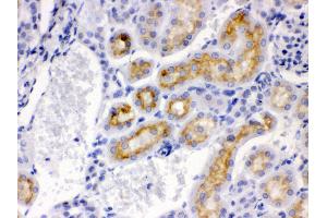 Anti- CYP24A1 Picoband antibody, IHC(P) IHC(P): Mouse Kidney Tissue (CYP24A1 antibody  (AA 153-514))