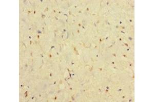Immunohistochemistry of paraffin-embedded human smooth muscle tissue using ABIN7156578 at dilution of 1:100 (IFNAR2 antibody  (AA 27-243))
