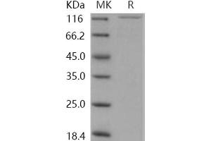 Western Blotting (WB) image for Mitogen-Activated Protein Kinase Kinase Kinase Kinase 5 (MAP4K5) protein (GST tag,His tag) (ABIN7317063) (MAP4K5 Protein (GST tag,His tag))