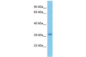 Host:  Rabbit  Target Name:  HDAC1  Sample Type:  Esophagus Tumor lysates  Antibody Dilution:  1. (HDAC1 antibody  (C-Term))
