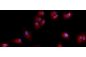 Immunofluorescence (IF) image for anti-Cofilin 1 (CFL1) (AA 1-166) antibody (PE) (ABIN5567003) (Cofilin antibody  (AA 1-166) (PE))