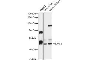 Western blot analysis of extracts of various cell lines, using S antibody (ABIN6132970, ABIN6147387, ABIN6147388 and ABIN6215904) at 1:1000 dilution. (SARS2 antibody  (AA 289-518))