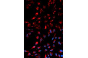 Immunofluorescence analysis of U2OS cells using CPE antibody (ABIN5973172).