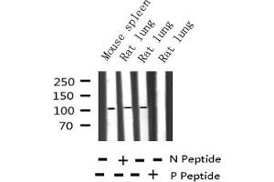 Western Blotting (WB) image for anti-Nuclear Factor of kappa Light Polypeptide Gene Enhancer in B-Cells 2 (NFKB2) (pSer866) antibody (ABIN6256439)
