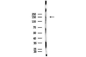 Western blot analysis of lysates from Mouse muscle, using Phospho-nNOS (Ser852) Antibody at 1/1000 dilution.