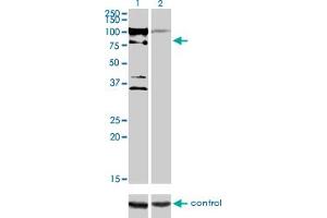 Western blot analysis of ZNF274 over-expressed 293 cell line, cotransfected with ZNF274 Validated Chimera RNAi (Lane 2) or non-transfected control (Lane 1). (ZNF274 antibody  (AA 420-530))