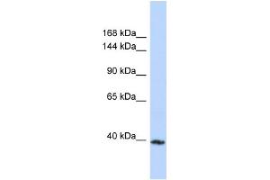 Host:  Rabbit  Target Name:  MYBPC3  Sample Type:  MCF7 Whole cell lysates  Antibody Dilution:  1.