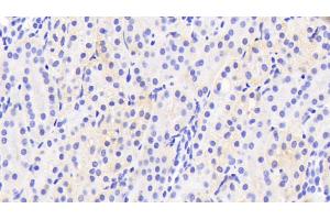 Detection of CYP2D6 in Human Kidney Tissue using Polyclonal Antibody to Cytochrome P450 2D6 (CYP2D6) (CYP2D6 antibody  (AA 236-472))