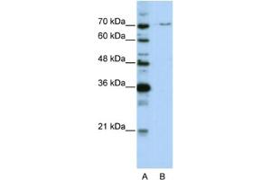 Western Blotting (WB) image for anti-PRP3 Pre-mRNA Processing Factor 3 Homolog (PRPF3) antibody (ABIN2462173) (PRPF3 antibody)