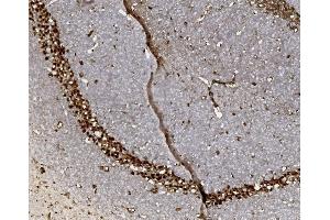 IHC analysis of FOXP1 using anti-FOXP1 antibody (ABIN7602780). (FOXP1 antibody  (C-Term))