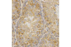 Immunohistochemistry (IHC) image for anti-Oxidized Low Density Lipoprotein (Lectin-Like) Receptor 1 (OLR1) (AA 58-273) antibody (ABIN1681162) (OLR1 antibody  (AA 58-273))