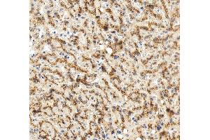 IHC analysis of LIMPII/SCARB2 using anti-LIMPII/SCARB2 antibody (ABIN7601833). (SCARB2 antibody  (AA 48-357))