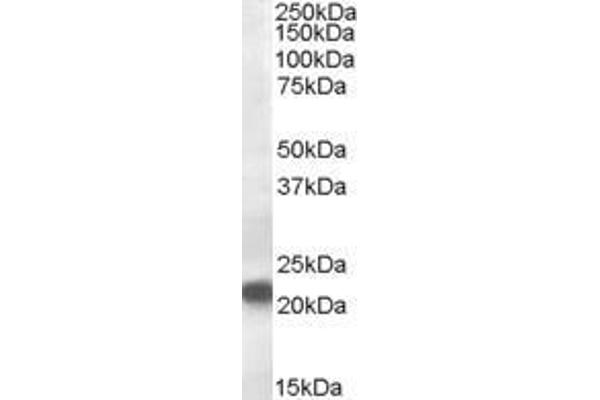 VPS25 antibody  (Internal Region)