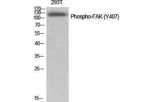 Western Blot (WB) analysis of specific cells using Phospho-FAK (Y407) Polyclonal Antibody. (FAK antibody  (pTyr407))