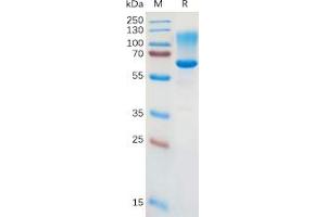 Human CD43 Protein, hFc Tag on SDS-PAGE under reducing condition. (CD43 Protein (Fc Tag))