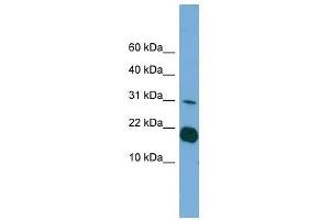 Western Blot showing IL1F5 antibody used at a concentration of 1-2 ug/ml to detect its target protein.